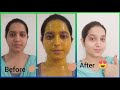 Home remedy for Fare and bright skin mask 💯% effective/reduce acne and reduce scars