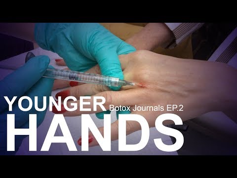 HOW TO MAKE YOUR HANDS LOOK YOUNGER