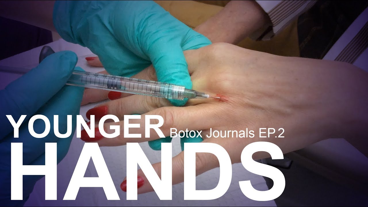 HOW TO MAKE YOUR HANDS LOOK YOUNGER - YouTube