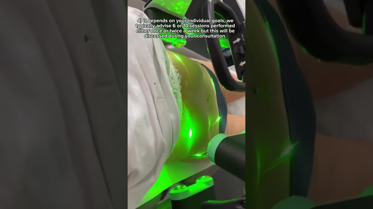 Non-surgical FAT LOSS treatment with Emerald Laser | Dr. Medispa