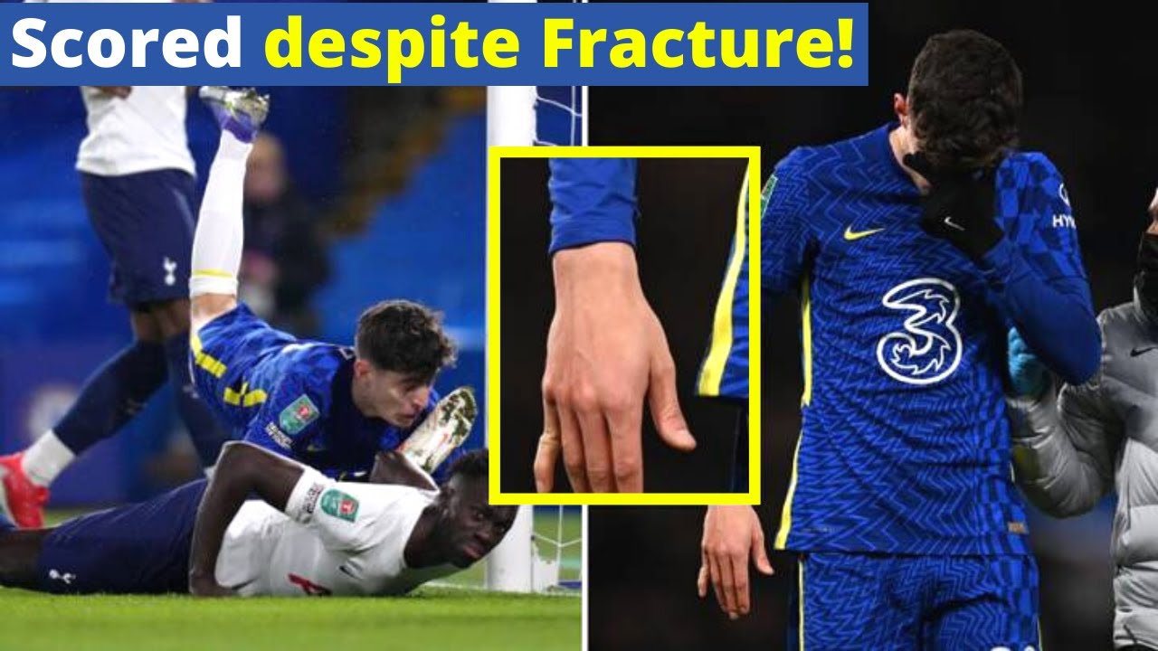 Havertz's painful celebration Played on with a fractured finger