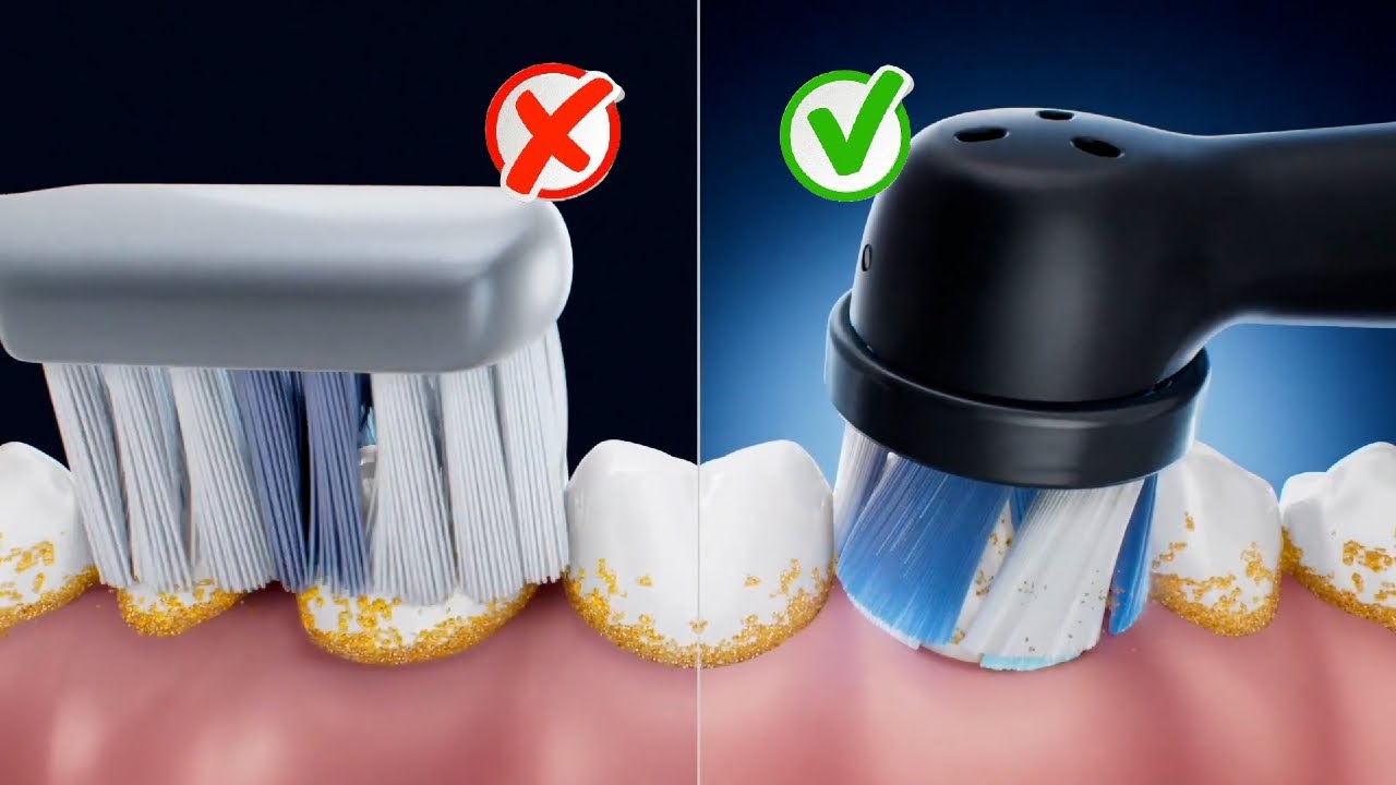 Top 5 Best Electric Toothbrushes 2024