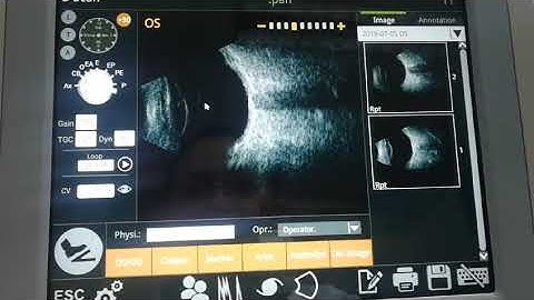 RetiWave-1000 Ophthalmic AB Ultrasound Scanner
