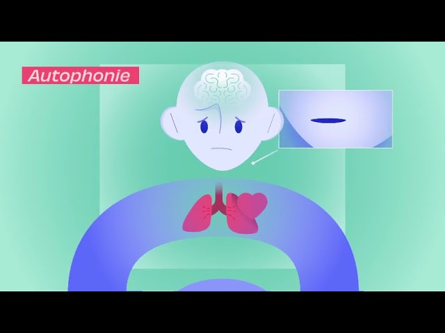 Courte vidéo explicative du syndrome de minor réalisée par le centre Vertico de l'hôpital Lariboisière de Paris et l'asso Syndrome de Minor.