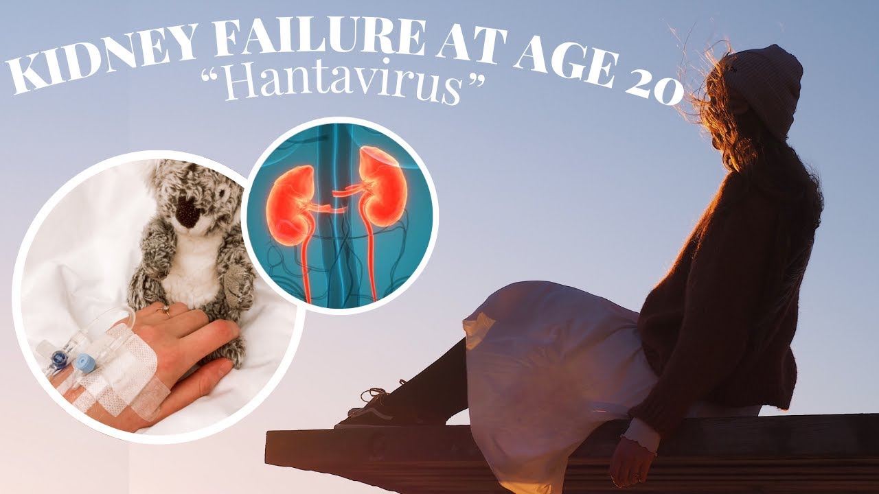 I GOT KIDNEY FAILURE AT AGE 20… My story - HANTAVIRUS