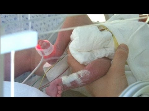 Vidéo: 6 Caractéristiques D'allaiter Un Bébé Prématuré