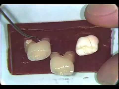 dental anatomy primary dentition youtube primary dentition