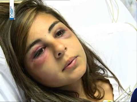 LBCI News تمارا حريصي كادت تدفع حياتها ثمن العنف الاسري