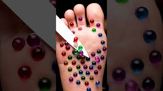 Removing Small Balls From Foot 🦶#ball#shorts