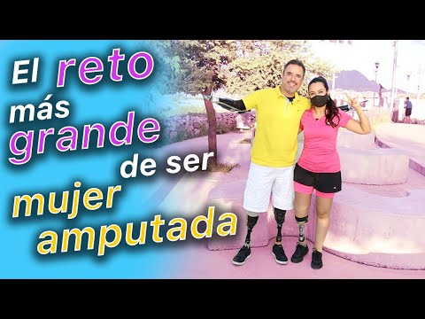 El RETO más grande de ser Mujer AMPUT4DA | Platicando con Cecy