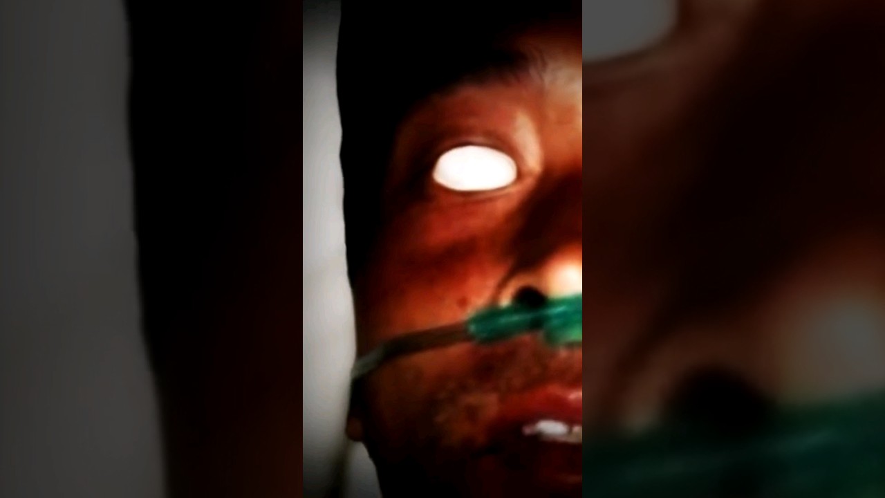 Hisashi Ouchi el hombre que soportó uno de los dolores más intensos de