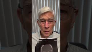 Major endoscopic sinus surgery 24 hours ago and ￼ and very comfortable