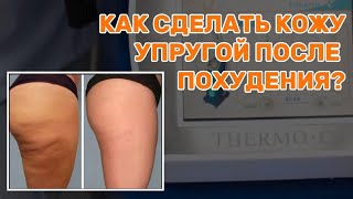 КАК СДЕЛАТЬ КОЖУ УПРУГОЙ ПОСЛЕ ПОХУДЕНИЯ? ТЕРМО СИ/ VELASHAPE 4D