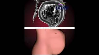 Twins fight Inside the Womb! ❤️ Pregnancy Animation