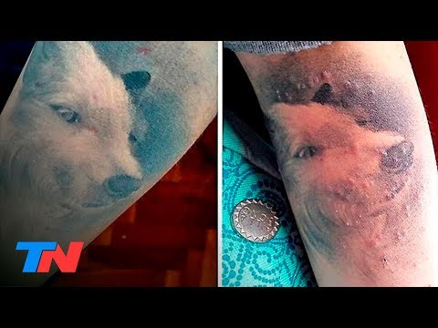 Vídeo: Erupción Del Tatuaje: Espinilla, Síntomas De Alergia O Infección. Más Tratamiento