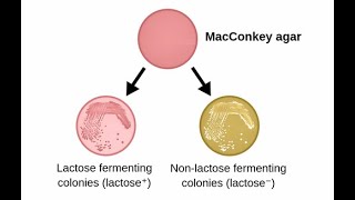 Selective Media and Differential Media in Microbiology