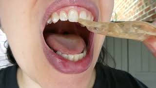 Old Retainer for Straightening Teeth Show Off! #teeth #retainer #mouth
