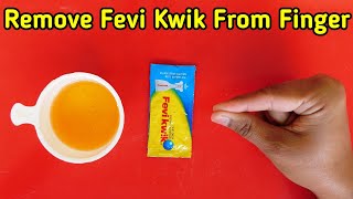 How To Remove Feviquick From Hand Feviquick Remover From Hand