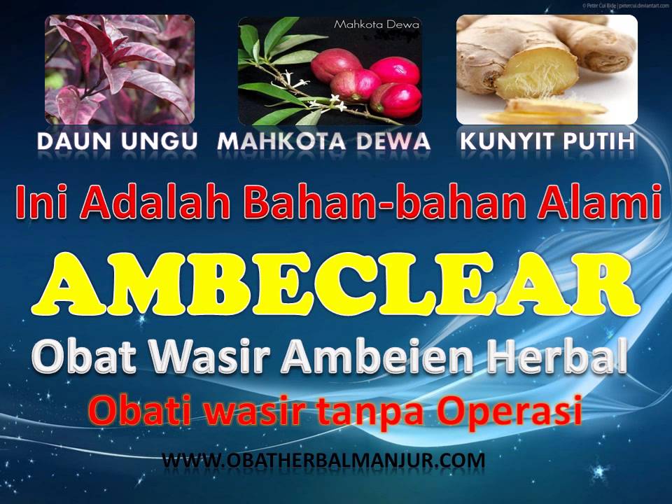 cara mengatasi wasir bengkak