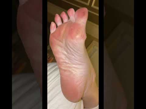 Wake Up To This In Your Face Foot Sole Arches Stinky Toes Mature Shortsvideo Youtubeshorts