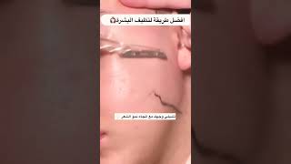 افضل طريقة لتنظيف وإزالة شعر الوجه