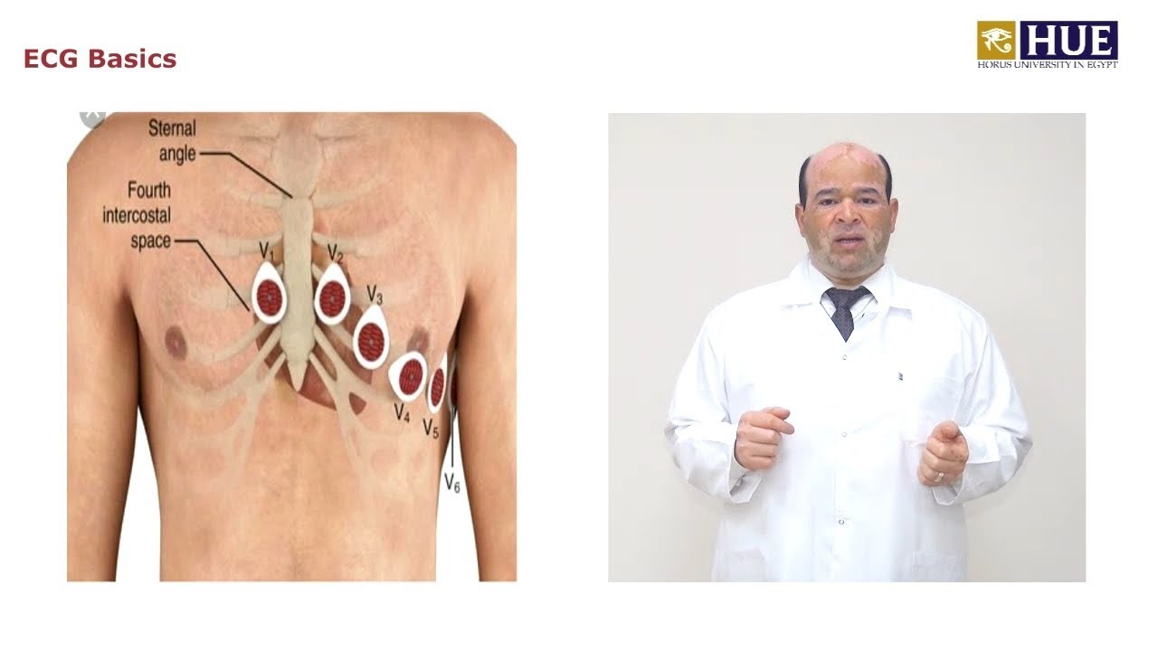 ECG Basics - Dr Lashin Saad - HUE