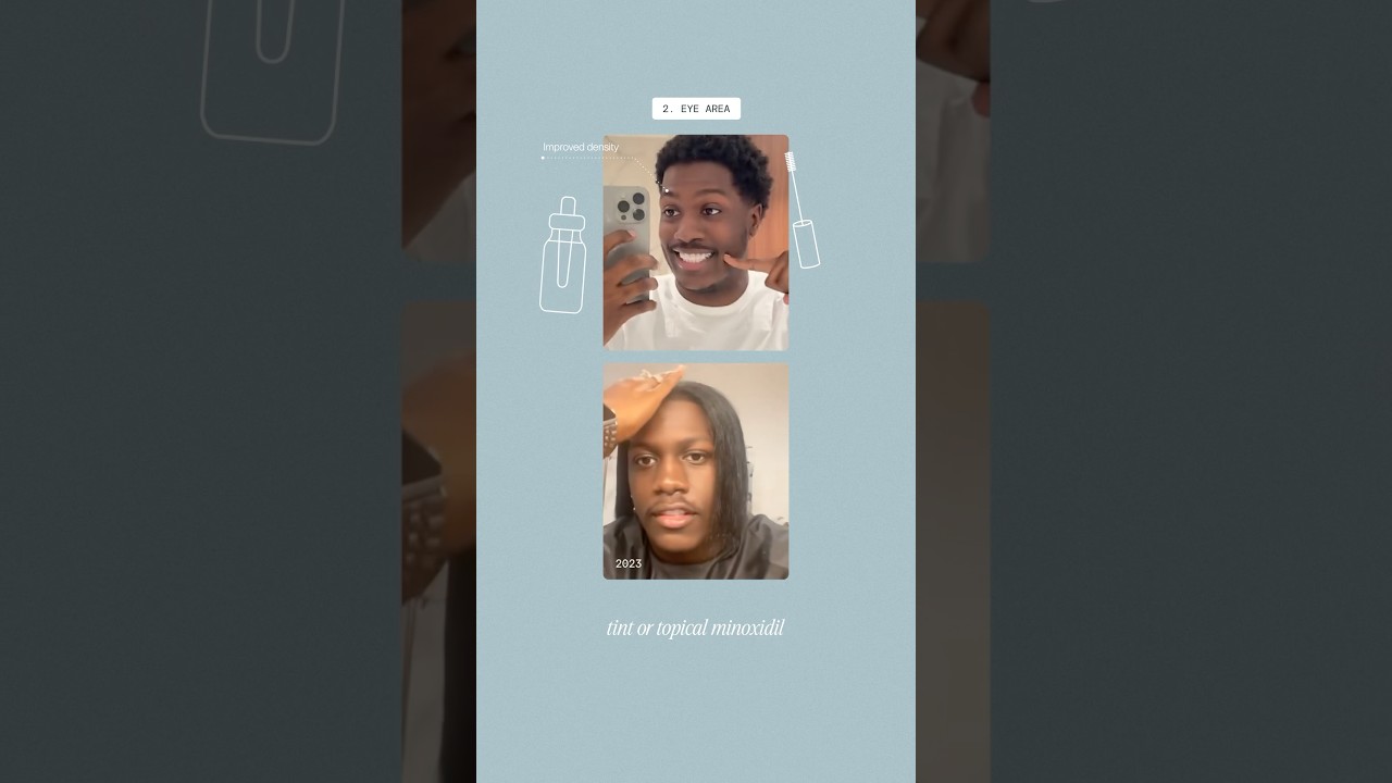 Lil Yatchy Glow Up Explained