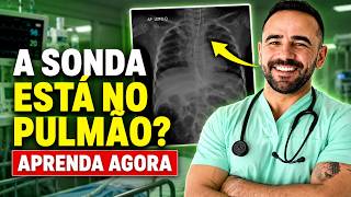 RADIOGRAFIA PARA POSIÇÃO DA SONDA ENTERAL - APRENDA AGORA