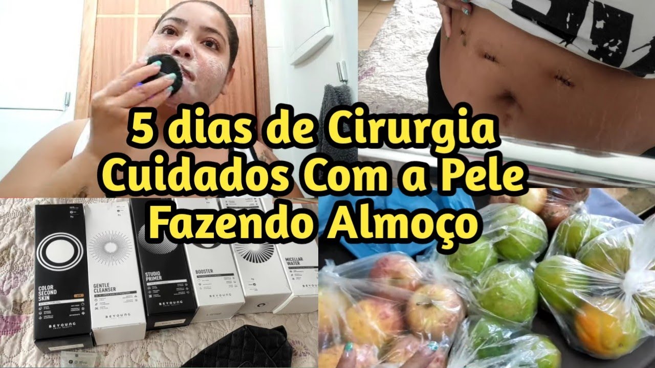 Voltando a Rotina 5 dias após Cirurgia Bariátrica