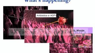 Dr. Aoife Corrigan - Issues in Developing Alternatives to Antimicrobials