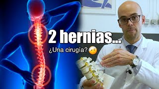 Hernia cervical y lumbar simultáneas: la guía para tomar la mejor decisión  | Biziondo