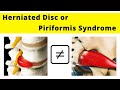 differences between a herniated disc and piriformis syndrome.