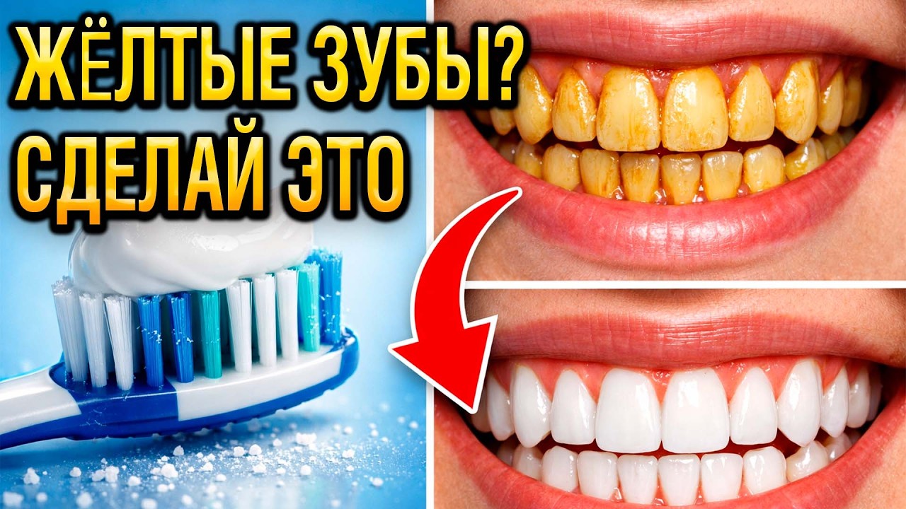 ЖЁЛТЫЕ ЗУБЫ? 7 СПОСОБОВ ОТБЕЛИТЬ ДОМА БЕЗ СТОМАТОЛОГА
