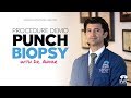 Punch Biopsy Demo - Skilled Wound Care