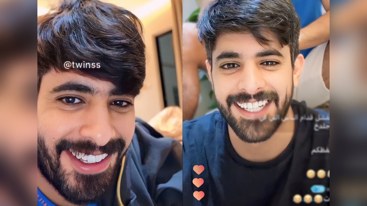 بث التوام العنزي (229)