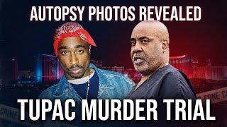 Tupac Murder Trial Autopsy Photos Reveal Fatal Injuries