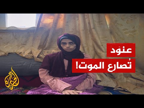 شابة من غزة تعاني مرض السرطان بحاجة إلى السفر للعلاج