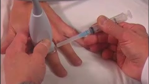 How To: Ultrasound-Guided Hand Injection Scanning Technique Video