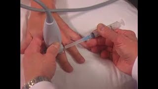 How To: Ultrasound-Guided Hand Injection Scanning Technique Video