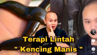 TERAPI LINTAH UNTUK KENCING MANIS
