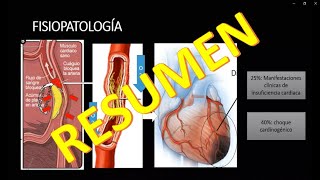 INFARTO AGUDO AL MIOCARDIO (IAM) FISIOPATOLOGIA