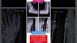 deodar motivation orthop genre hospital diyodar trends anatomy orthocentre