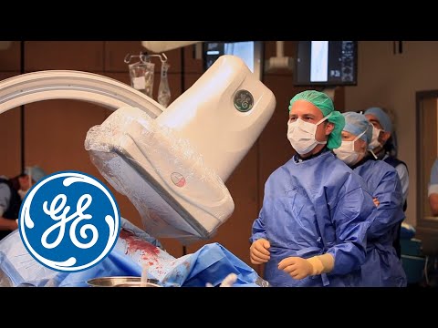 Successfully guide CTO recanalization in lower limbs with Vessel ASSIST | GE Healthcare