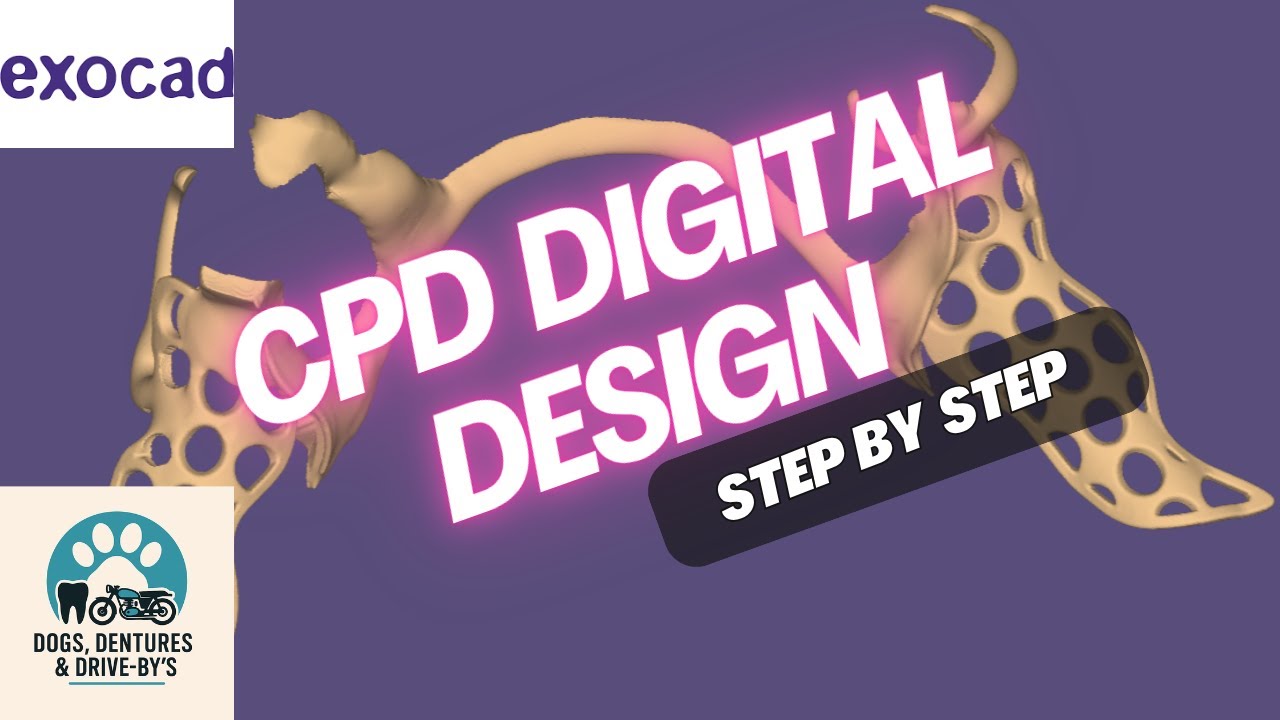 Exodad Rpds Design a RPD Framework with Me ! - ExoCAD CPD Tutorial - YouTube