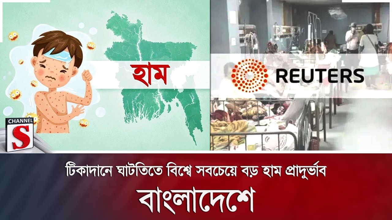 টিকাদানে ঘাটতিতে বিশ্বে সবচেয়ে বড় হাম প্রাদুর্ভাব বাংলাদেশে | Channel S News