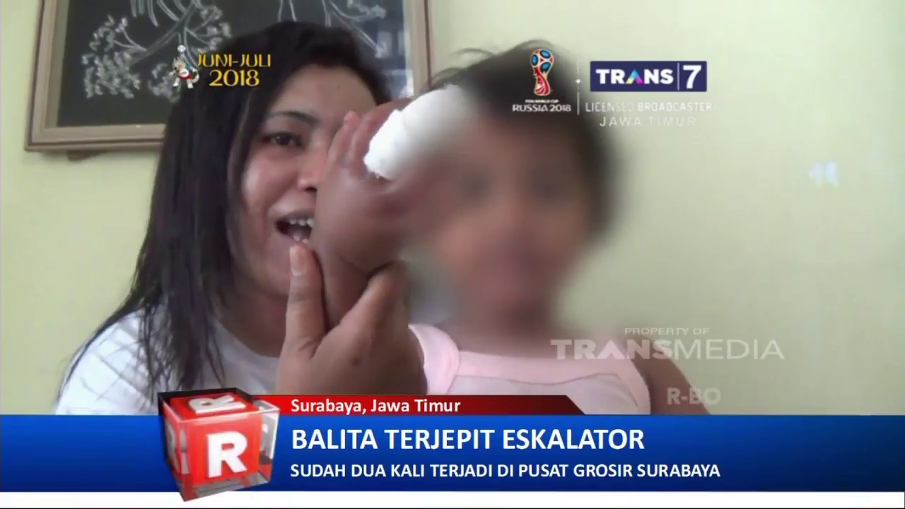 Lompat Dari Gendong, Balita Terjepit Eskalator