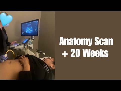 Anatomy Scan + 20 Weeks | Pregnancy Vlog 9
