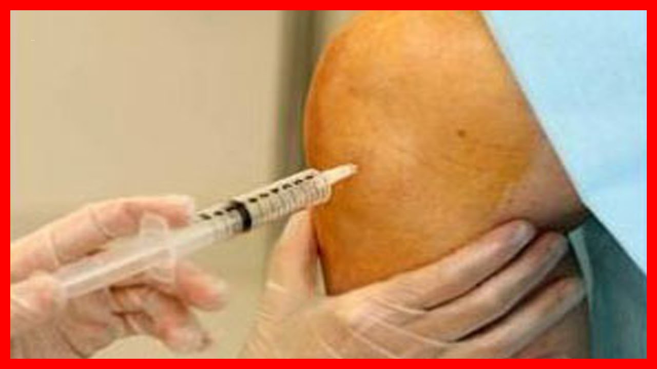 Artrosis: Qué es, Sintomas, Recomendaciones y Consejos para Pacientes sida origine