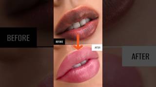 Black to Pink lips naturally at home | Lip pigmentation removal lip balm # #ashortaday #trending screenshot 5