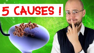 CANCER de la VESSIE : 5 grandes causes !